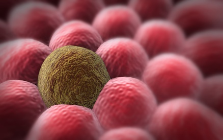 Game changer for the fight against cancer?